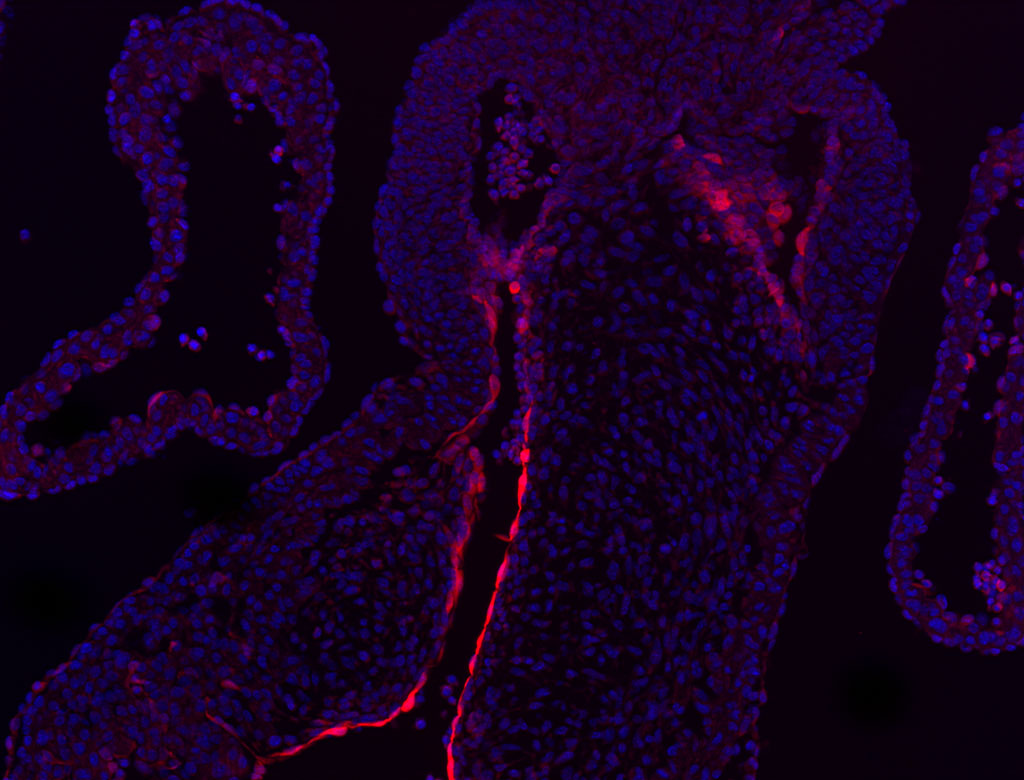 RBP1 gene expression in a mouse embryonic heart